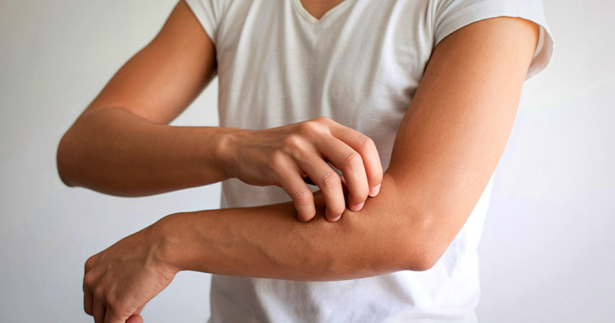Mast Cell Activation Syndrome: The Condition Your Doctor May Have Missed and What Acupuncture Can Do About It