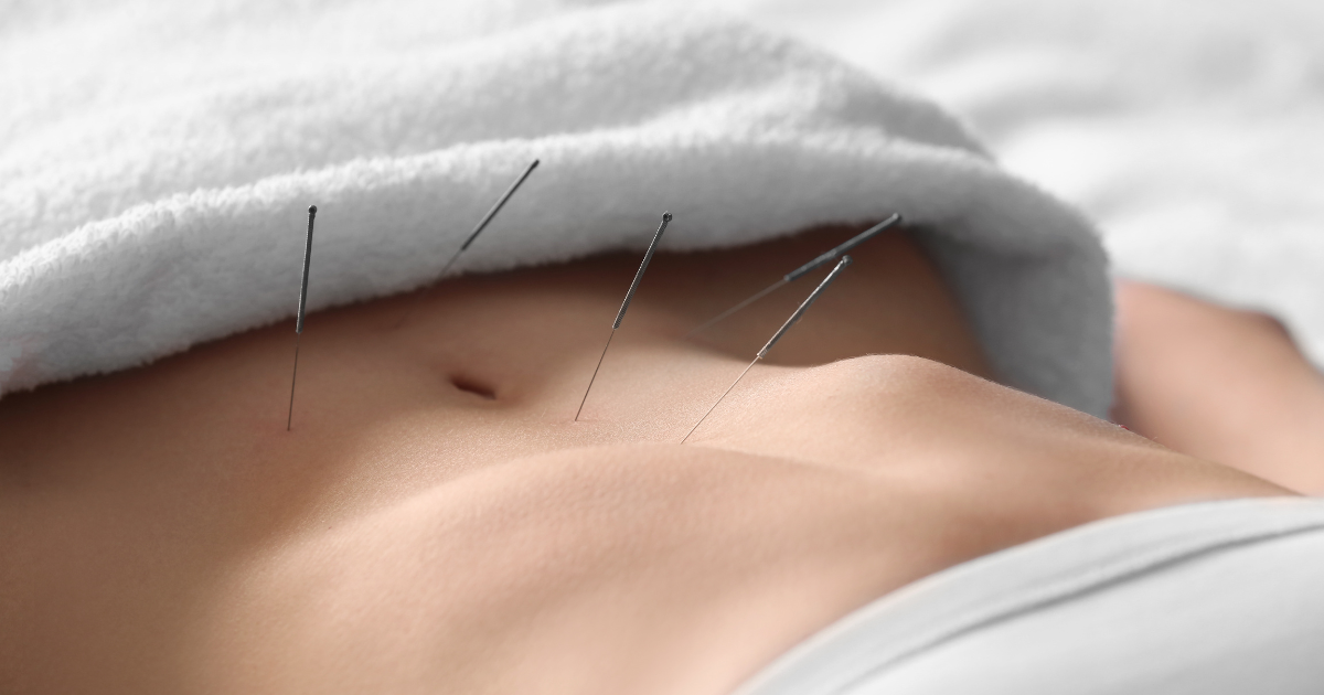 Acupuncture for Fertility in Sheboygan County: What the Research Says and What I See in Practice